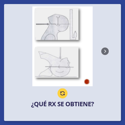 RXFOT