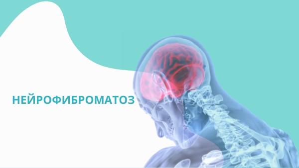 Нейрофиброматоз