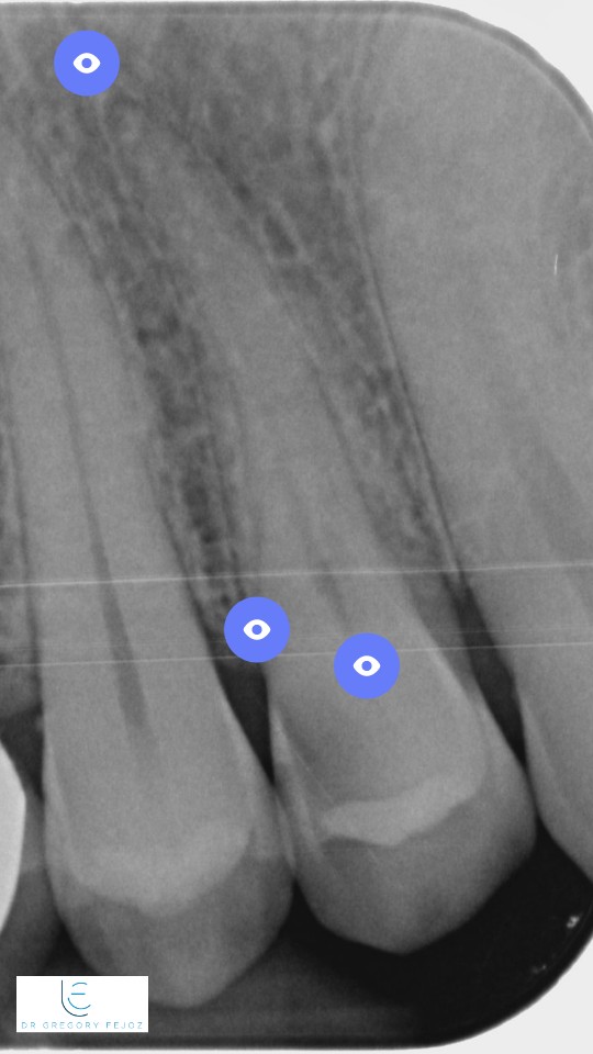 FORMATION - RADIOGRAPHIE DENTAIRE