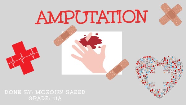 Amputation