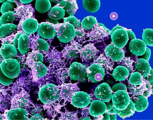 staphylococcus epidermis | Genially