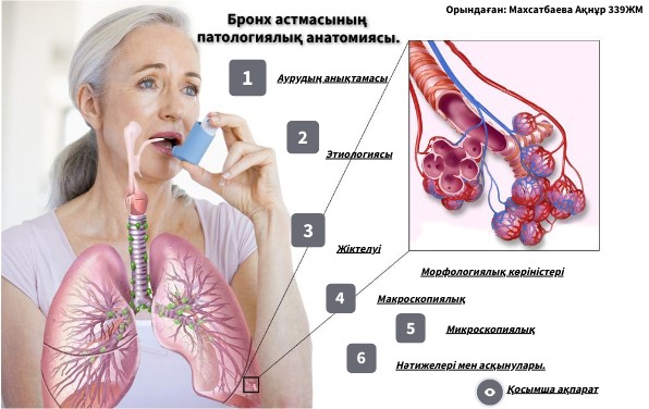 БРОНХ АСТМА