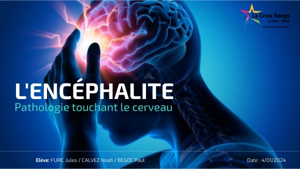 L'encéphalite par jules furic ; noah calvez et paul begoc