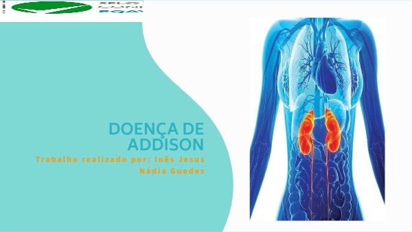 DOENÇA DE ADDISON | Genially