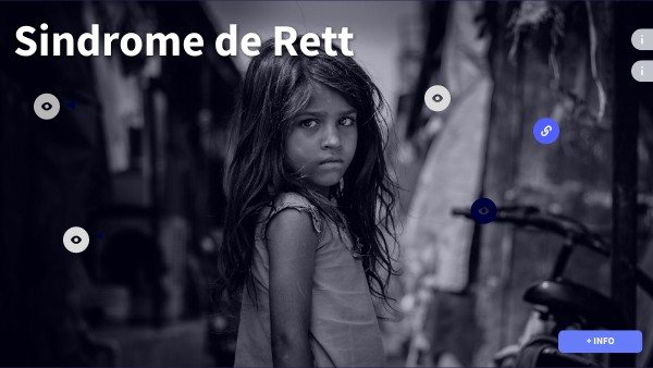 Síndrome de Rett