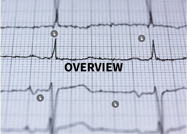 Angina | Genially